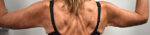Brachioplasty